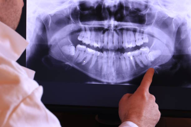 Best Emergency Dental Care for Broken or Chipped Teeth in Pittsburg, TX