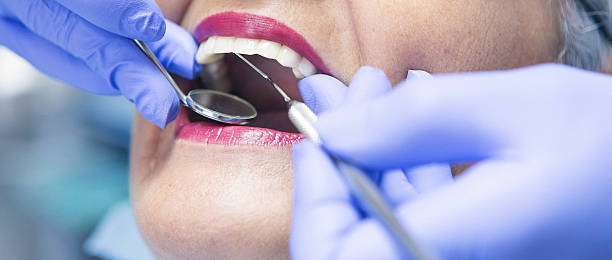 Best Emergency Tooth Extraction in Pittsburg, TX
